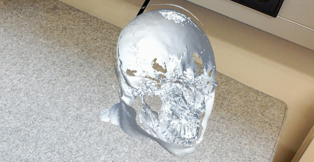 MRI of a skull sliced through the near clipping plane, as seen in HoloLens