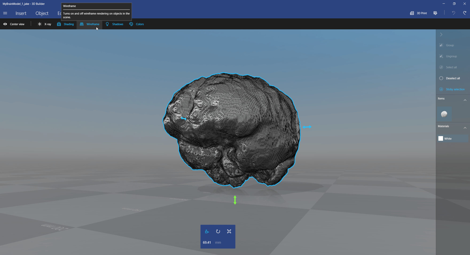 3D Builder: show 3D model of brain segmented from MRI / MRT image