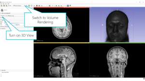 Visualizing MRI & CT Scans in Mixed Reality / VR / AR, Part 2: 3D ...