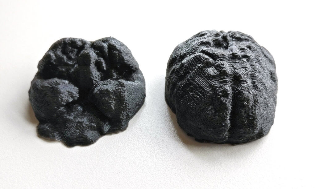 3D Printed brain halves, segmented from MRI image