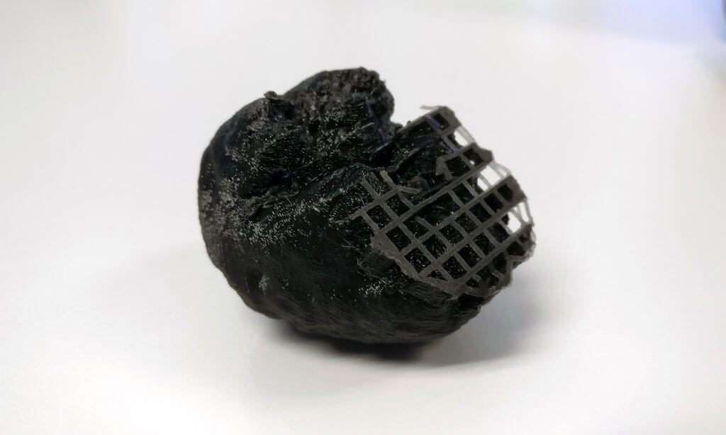 Result of 3D printing a brain segmented from MRI, with supporting material partly removed