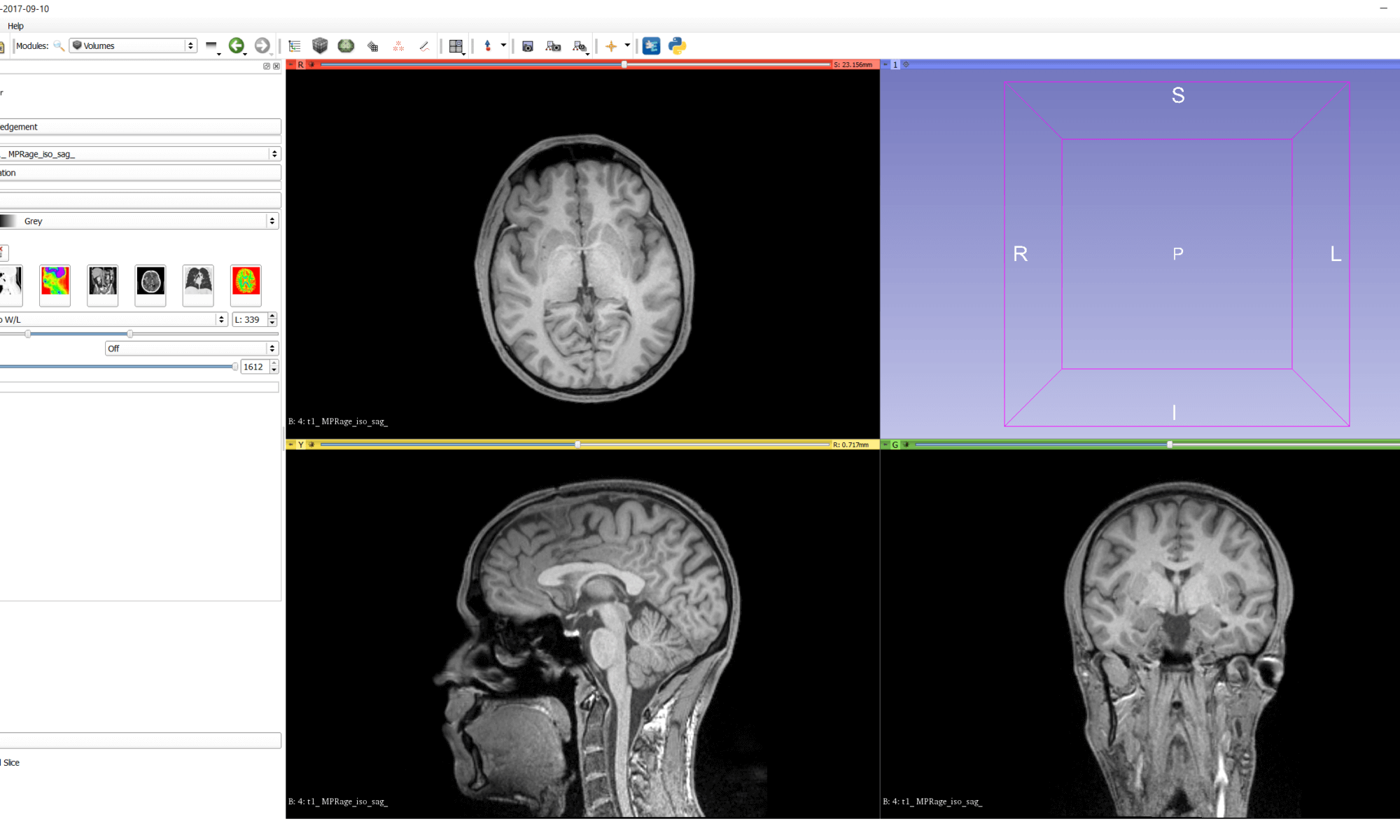 Ct Iam Scan Ct Scan Machine