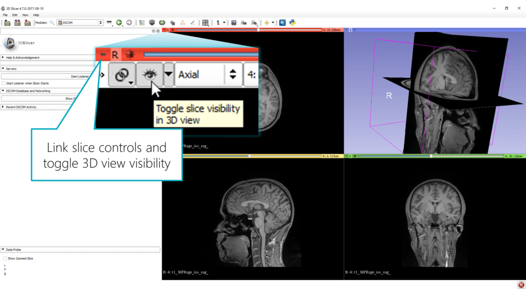 Activating 3D View of MRI images in 3D Slicer