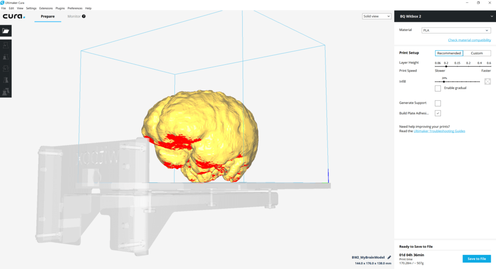 Overhang of the segmented 3D brain is shown in red by Cura