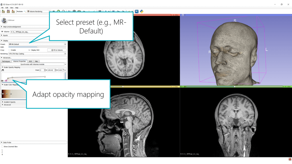 MR Default mapping for opacity and color in 3D Slicer