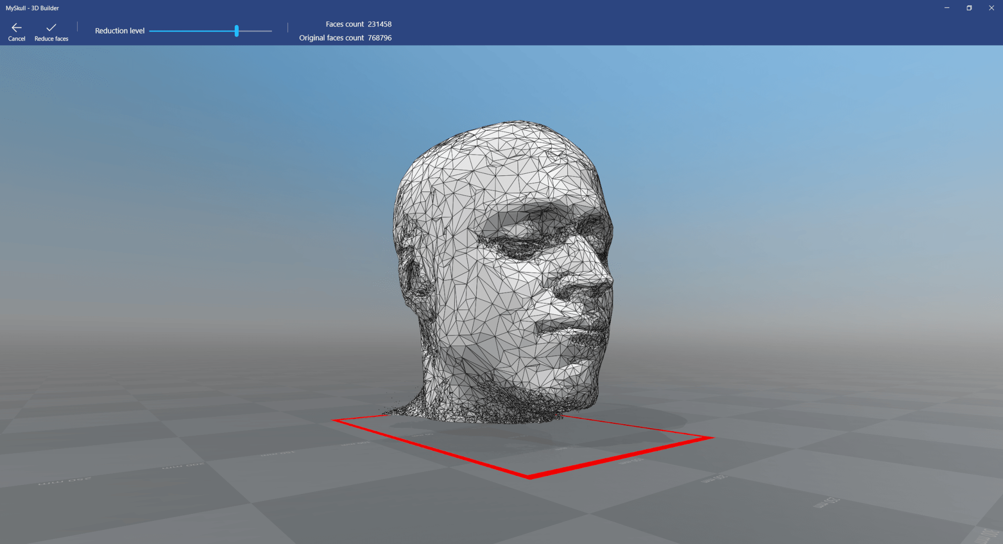 MRI 3D Model visualized in Windows 10 3D Builder