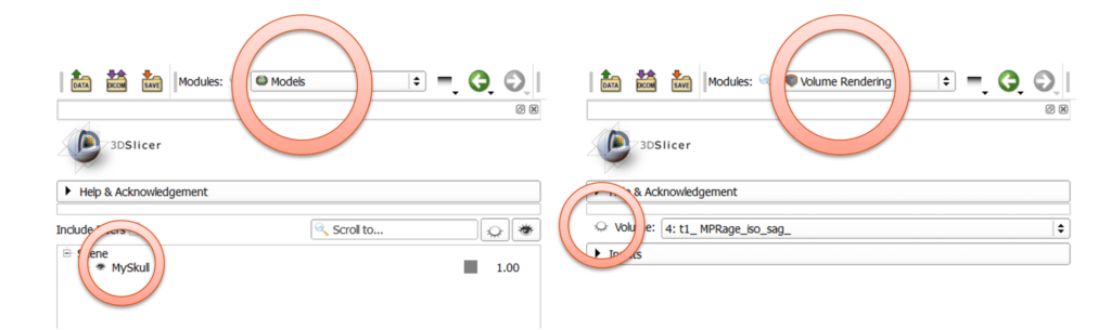 Toggle Model and Volume Rendering Visibility in 3D Slicer