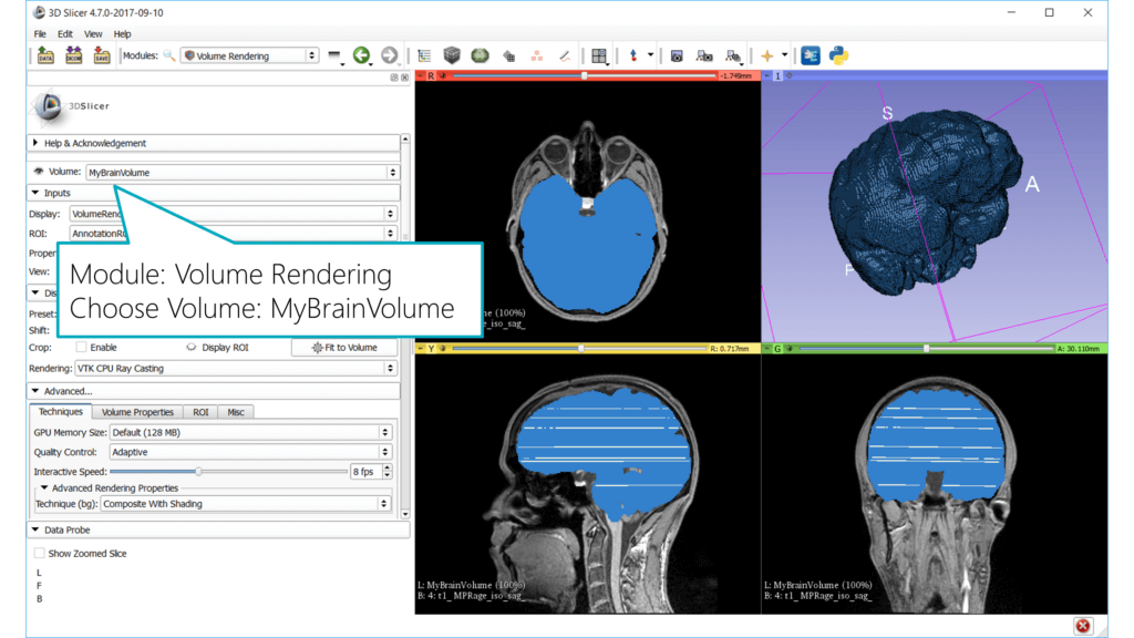 Slicer: 3D Volume of segmented brain from MRI data