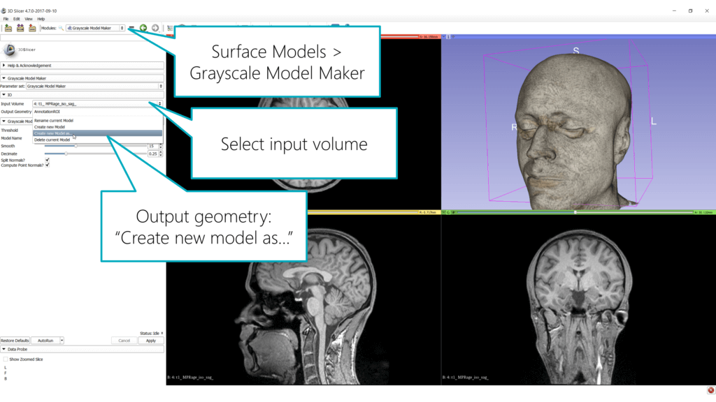 Visualizing MRI & CT Scans in Mixed Reality / VR / AR, Part 3 3D Model