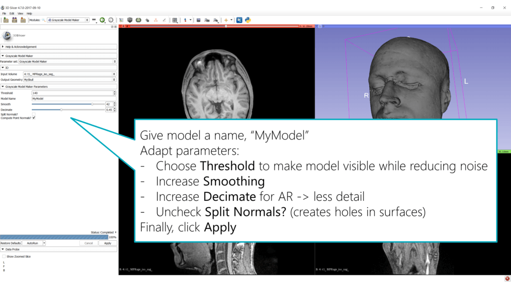 3D Slicer - Grayscale Model Maker parameters
