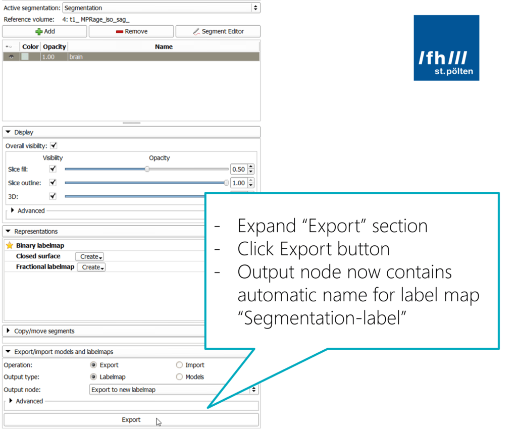 Slicer: Export segmentation as labelmap