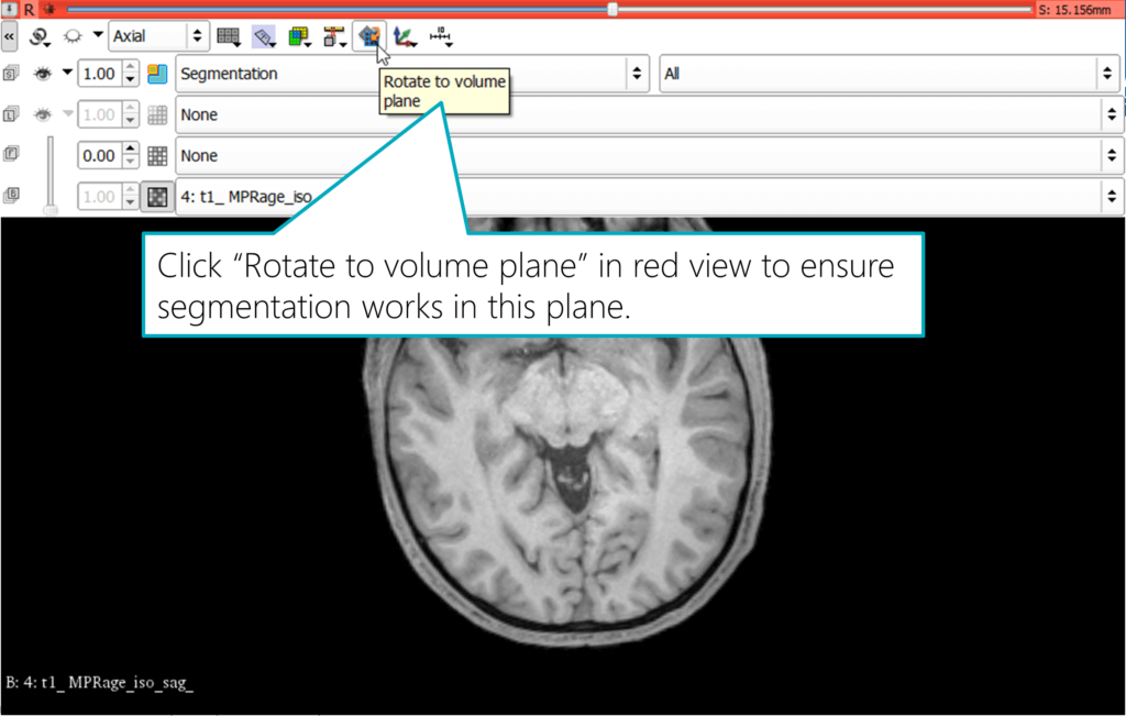 Rotate a view to the Volume Plane in Slicer