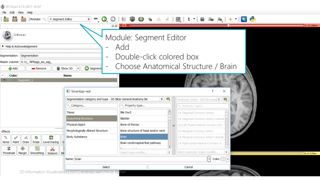 Select Brain segment category in 3D Slicer