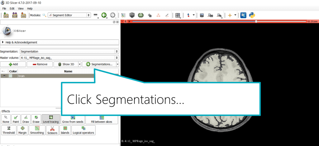 Slicer: Export the Segmentation, step 1