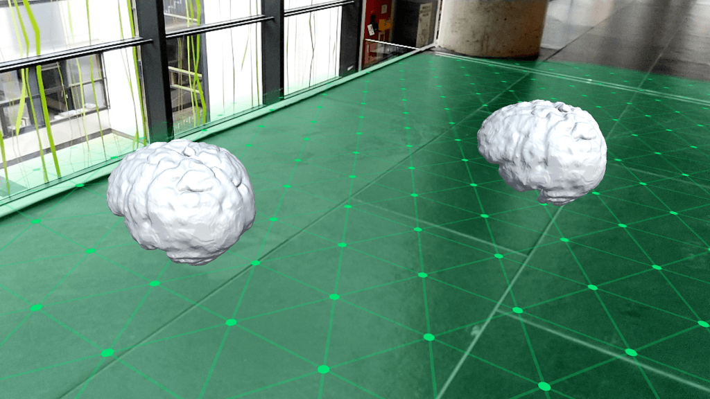 Placing 3D models of brains on planes detected by Google ARCore - Screenshot running on the Google Pixel 2